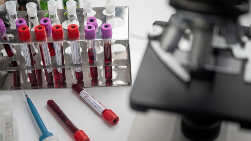 Свыше 168,5 млн тестов на ковид провели в России с начала пандемии